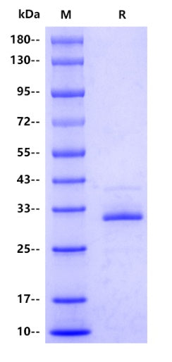 Mouse CXCL10/IP-10/CRG-2 Protein, hFc tag