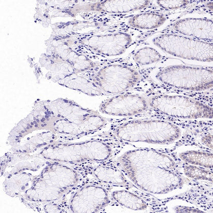 PRMT5 Recombinant Rabbit mAb (S-2336-126)