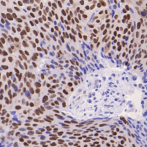Phospho-ATF-2 (Thr71)/ATF-7 (Thr53) Recombinant Rabbit mAb (S-3535)