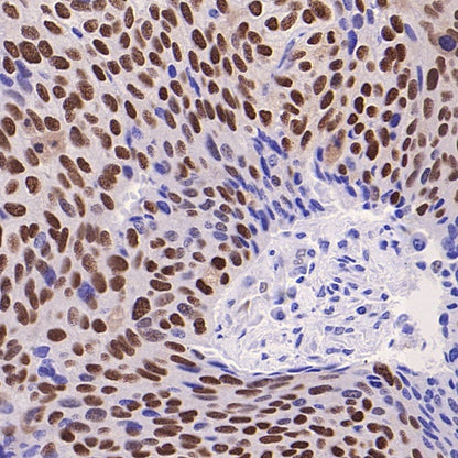 Phospho-ATF-2 (Thr71)/ATF-7 (Thr53) Recombinant Rabbit mAb (S-3535)