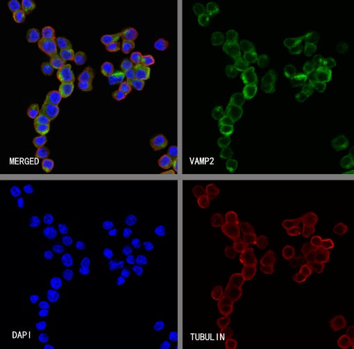 VAMP2 Recombinant Rabbit mAb (S-2359-2)