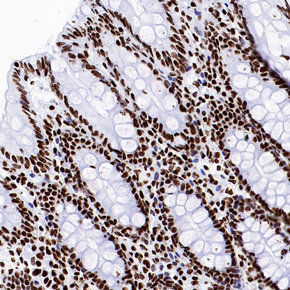 Histone H3 (acetyl K18) Recombinant Rabbit mAb (S-1688-90)