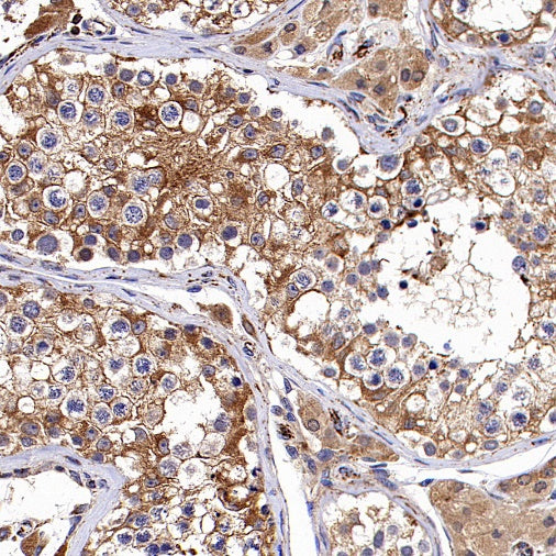 Hexokinase II Rabbit Polyclonal Antibody