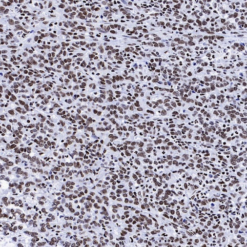 Histone H4 (Lactyl K8) Recombinant Rabbit mAb (S-3243-36)