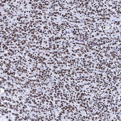Histone H4 (Lactyl K8) Recombinant Rabbit mAb (S-3243-36)