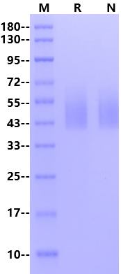 NPC1 His Tag Protein, Human