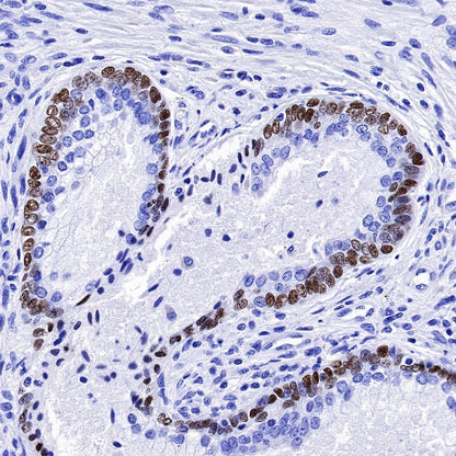 p63 Recombinant Rabbit mAb (SDT-054-137)
