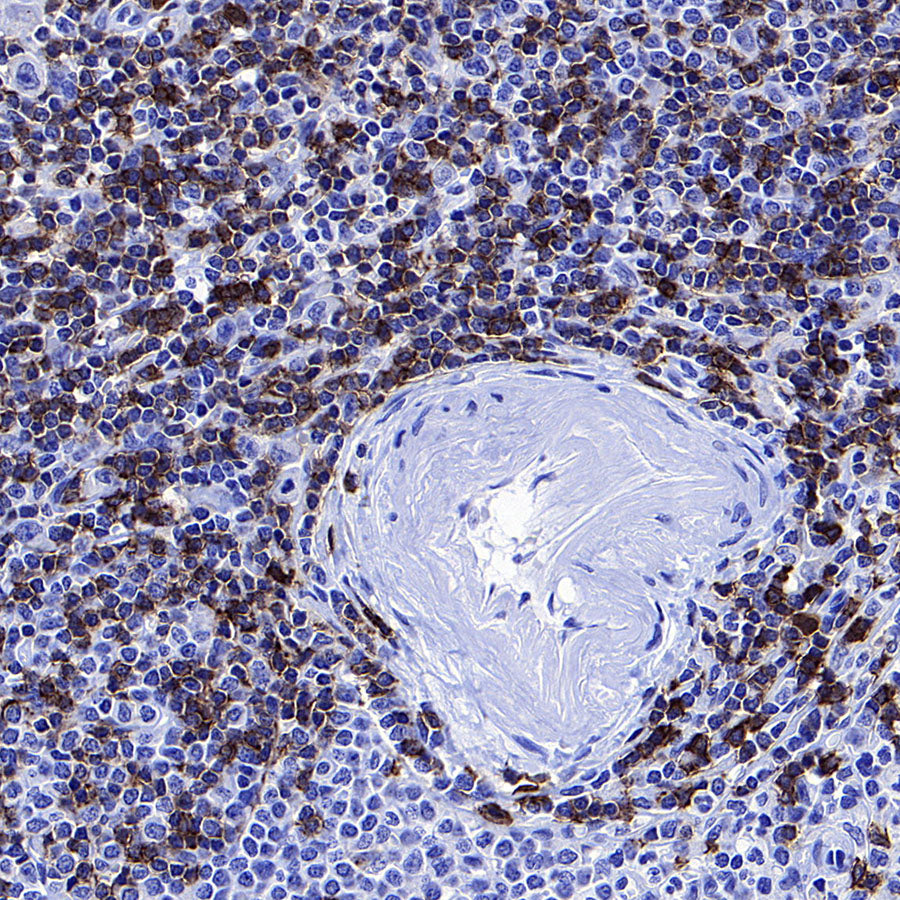 CD127 Recombinant Rabbit mAb (S-4826)