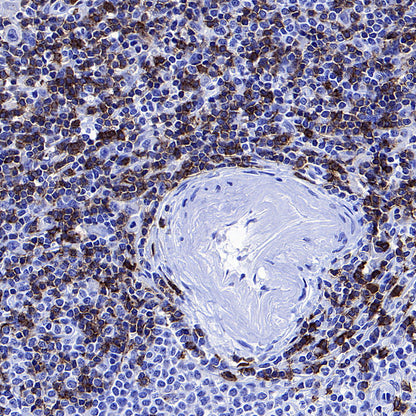 CD127 Recombinant Rabbit mAb (S-4826)