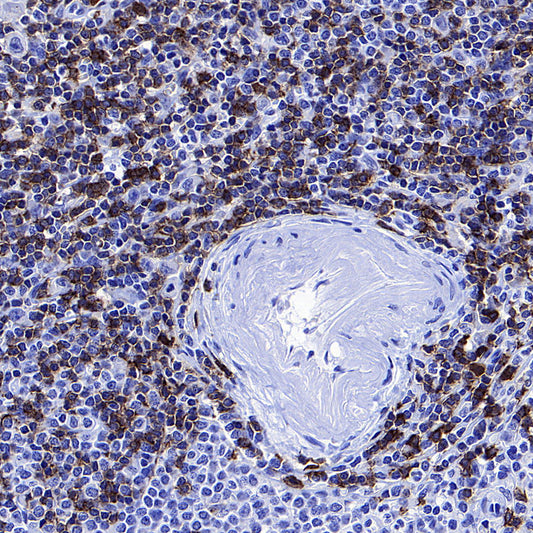 CD127 Recombinant Rabbit mAb (S-4826)
