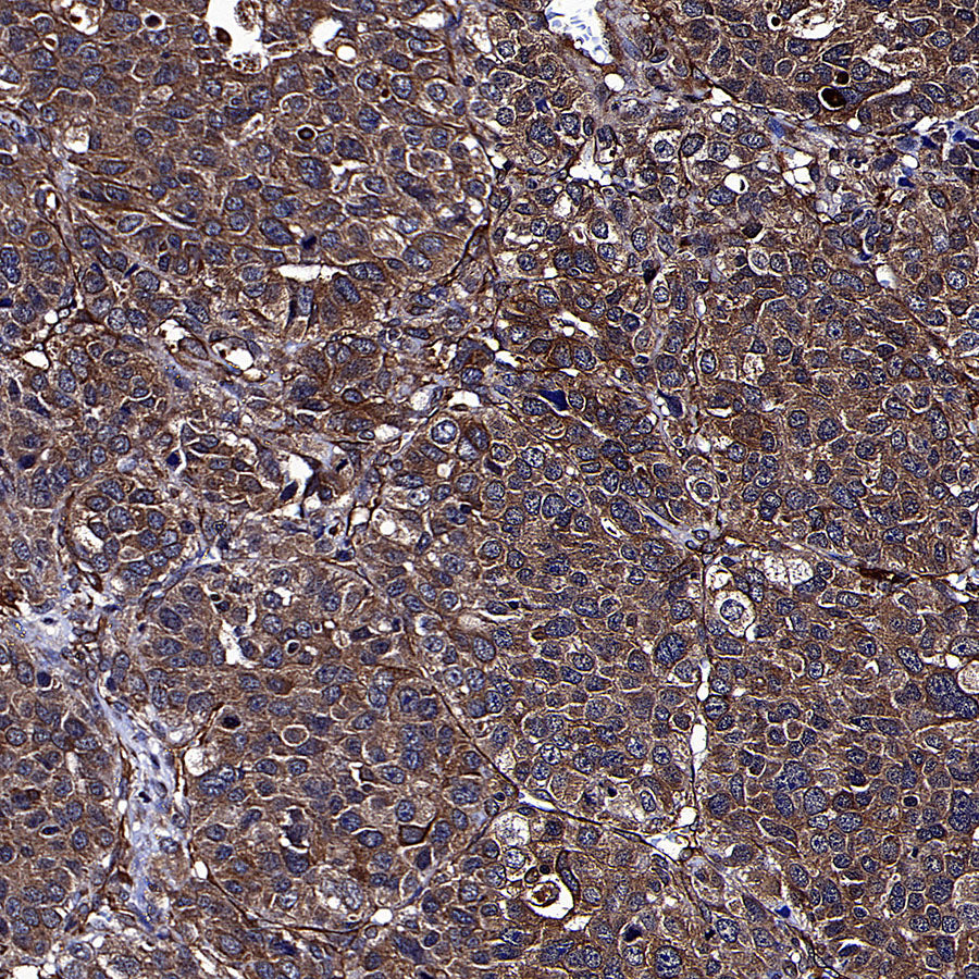 TUBA1A Rabbit Polyclonal Antibody
