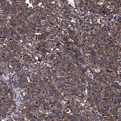 TUBA1A Rabbit Polyclonal Antibody