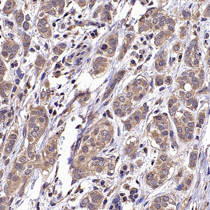 HLA Class I-A Recombinant Mouse mAb (S-3834)