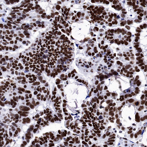 NuMA Recombinant Rabbit mAb (SDT-474-241)