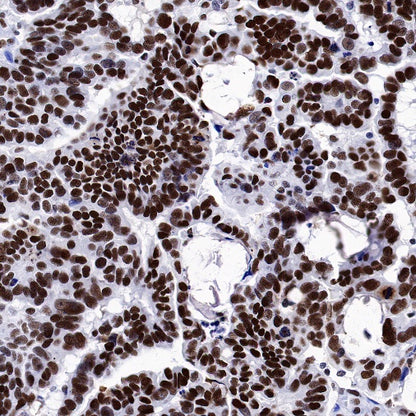 NuMA Recombinant Rabbit mAb (SDT-474-241)