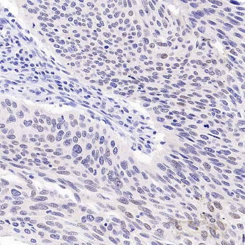 CDKN2A/p16 INK4A Recombinant Rabbit mAb (S-4676)