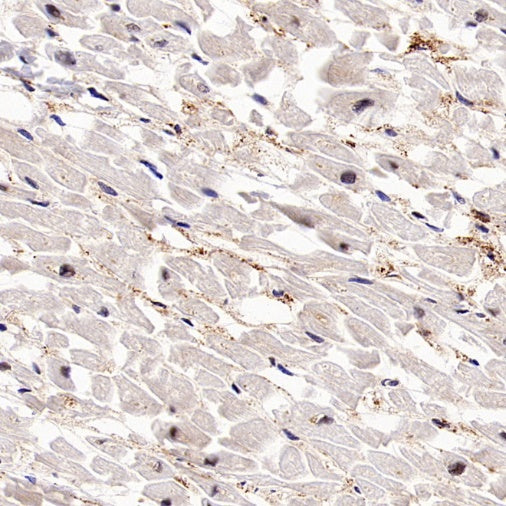 PSME4 Recombinant Rabbit mAb (S-3132-44)