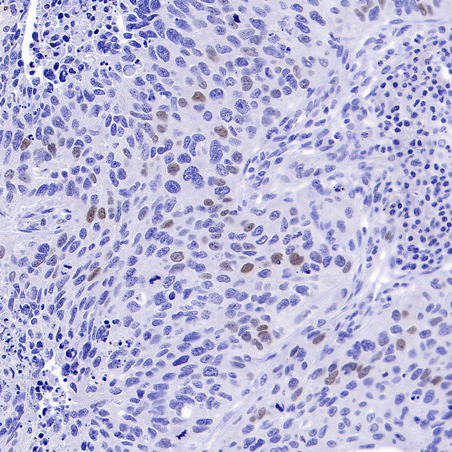 Cyclin E2 Recombinant Rabbit mAb (S-5247)