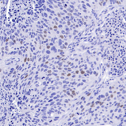 Cyclin E2 Recombinant Rabbit mAb (S-5247)