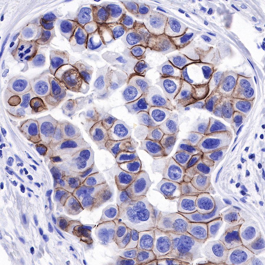Nectin-4 Recombinant Rabbit mAb (SDT-277-229)