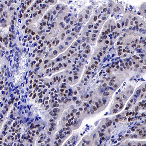 PES1 Recombinant Rat mAb (SDT-R197)