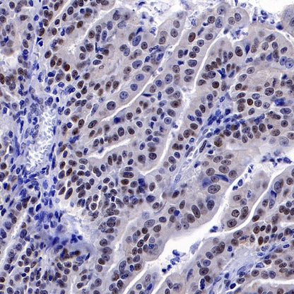 PES1 Recombinant Rat mAb (SDT-R197)