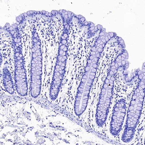 Myelin Oligodendrocyte Glycoprotein (MOG) Recombinant Rabbit mAb (S-1384-61)