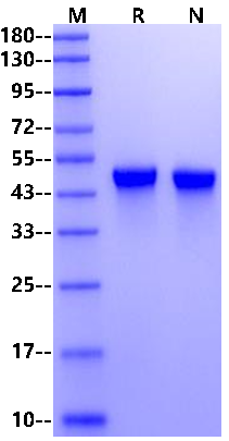 VSIG4 His Tag Protein, Human