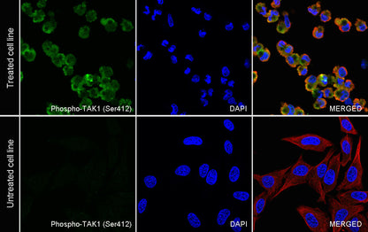 Phospho-TAK1 (Ser412) Recombinant Rabbit mAb (S-3334-138)