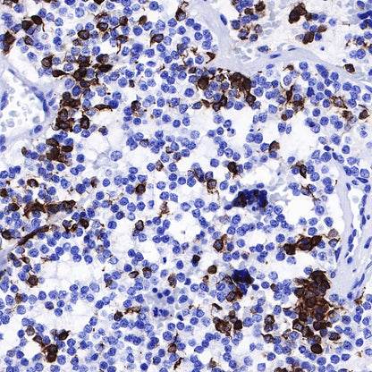 GFAP Recombinant Rabbit mAb (SDT-306-10)