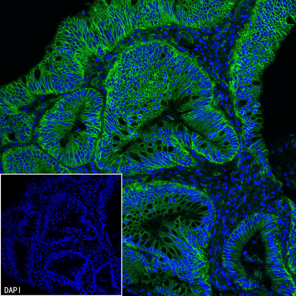 CD151 Recombinant Rabbit mAb (S-3235-104)