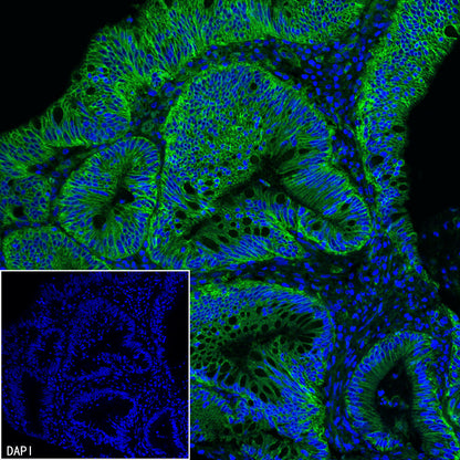 CD151 Recombinant Rabbit mAb (S-3235-104)