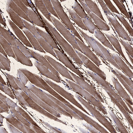 Neuropilin 1 Recombinant Rabbit mAb (S-1453-6)