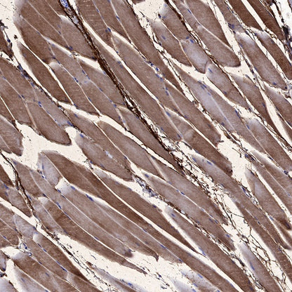Neuropilin 1 Recombinant Rabbit mAb (S-1453-6)