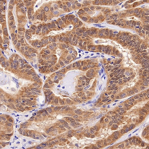 Prohibitin Recombinant Rabbit mAb (S-2679-7)