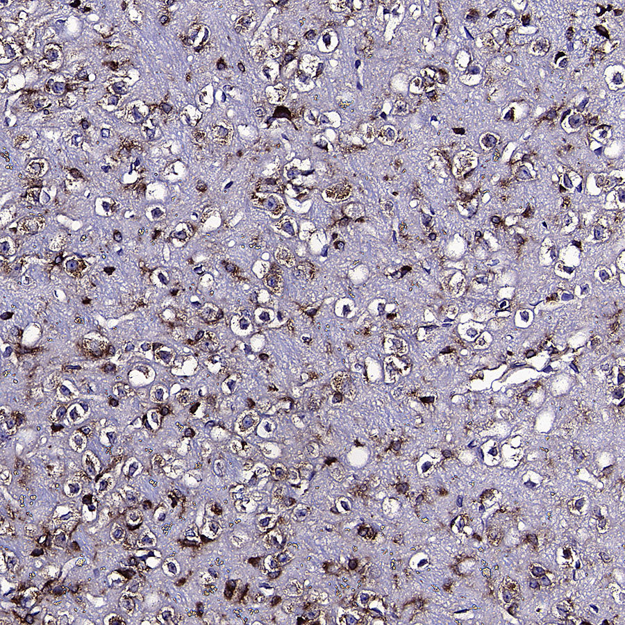 PUMA Recombinant Rabbit mAb
