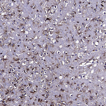 PUMA Recombinant Rabbit mAb