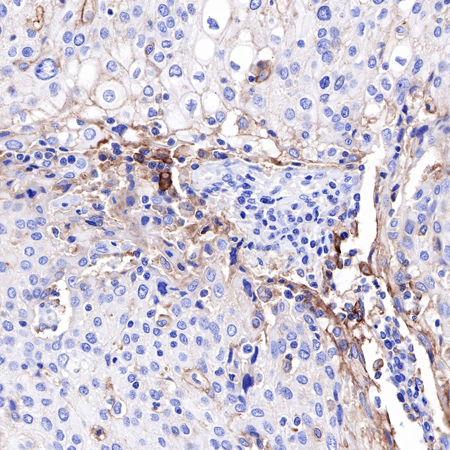 PD-L1 Recombinant Rabbit mAb,PBS Only (SDT-R017)