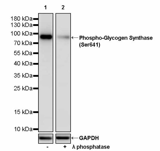 Phospho-Glycogen Synthase (Ser641) Recombinant Rabbit mAb (S-2765-18)