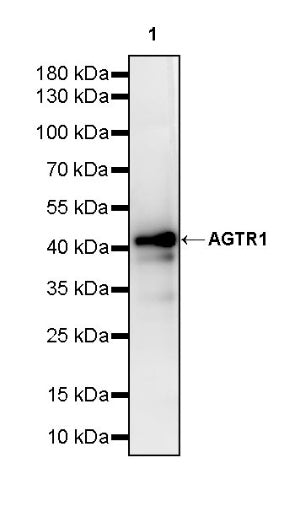 AGTR1 Recombinant Rabbit mAb (S-2447-22)