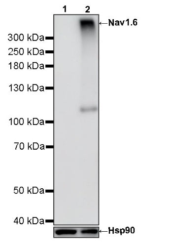 Nav1.6 Recombinant Rabbit mAb (S-4298-3)