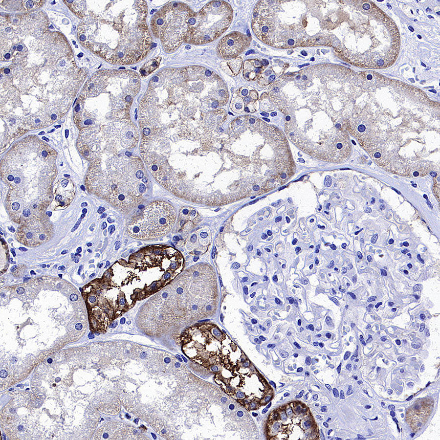 ATP1B1 Rabbit Polyclonal Antibody