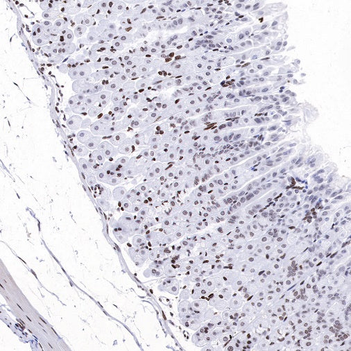 Histone H3 (di methyl K14) Recombinant Rabbit mAb (S-R414)