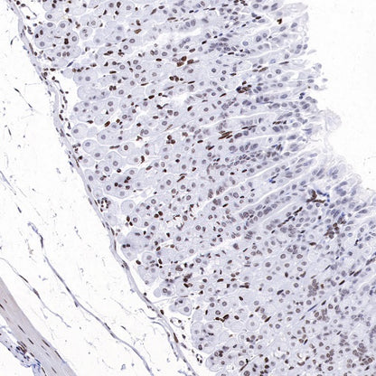 Histone H3 (di methyl K14) Recombinant Rabbit mAb (S-R414)