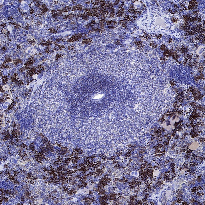 FoxO3a Recombinant Rabbit mAb (S-465-41)