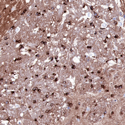 Tau Recombinant Rabbit mAb (SDT-171-67)
