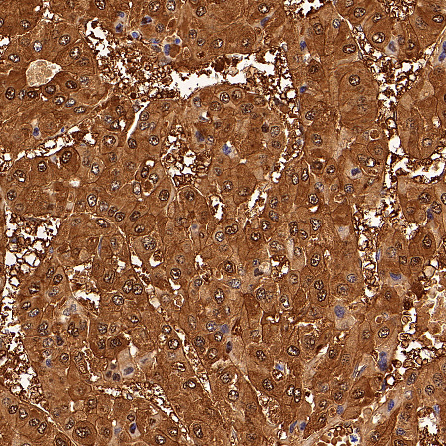 HPD Recombinant Rabbit mAb (S-4536-65)