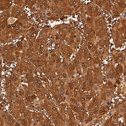 HPD Recombinant Rabbit mAb (S-4536-65)