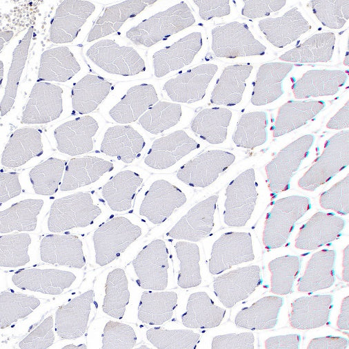 TRF Recombinant Rabbit mAb (S-613-85)