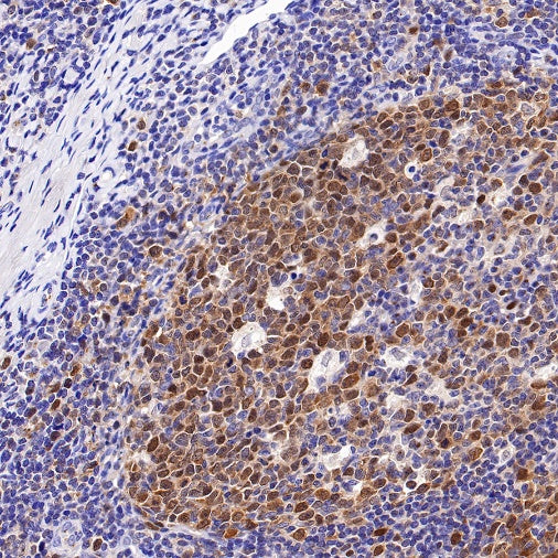 CDK2 Recombinant Rabbit mAb (S-1308-13)